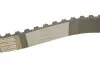Комплект ГРМ Audi A4/A6/A8 97-06/Skoda Superb 01-08/VW Passat 2.5TDI 98-05 (24x87z) HEPU 20-1176 (фото 6)