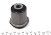 Сайлентблок важеля (переднього/знизу/ззаду) Hyundai Tucson 2.0 04-10/Kia Sportage 2.0 04- KAVO PARTS SCR-4071 (фото 3)