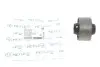 Сайлентблок важеля (переднього/спереду) Hyundai Tucson/Accent/Kia Sportage 04- 37-14 610 0006