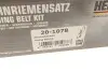 Комплект ГРМ Renault Kangoo 1.2i 97- (17x87z) HEPU 20-1078 (фото 10)