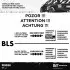 Розподільчий вал (к-т) ET ENGINETEAM HV0340 (фото 10)