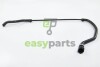 Патрубок радіатора BMW 1(E81/E88) / 3(E90/E91/E93) 1.6/2.0 05-13 RAPRO R19628 (фото 2)