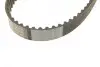 Комплект ГРМ Audi A4/A6/Q5 04-12 HEPU 20-1764 (фото 5)