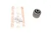 Сайлентблок важеля (переднього) BMW 3 (F30/F80/F31)/4 (F32/F82/F33/F83)/X3 (F25) 11- ASMETAL 38BM2600 (фото 5)