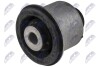 ARM BUSHING GUMOWO-METALOWA NTY ZTP-BM-013A (фото 2)